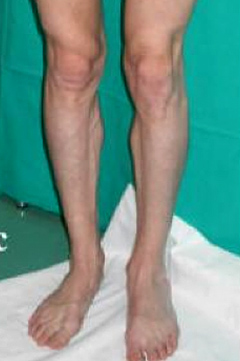 Skinny calves best sale and ankles